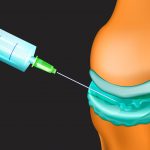 knee pain joint injections Atlantic Medical Group Canton Ohio