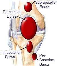 knee pain bursitis Atlantic Medical Group Canton